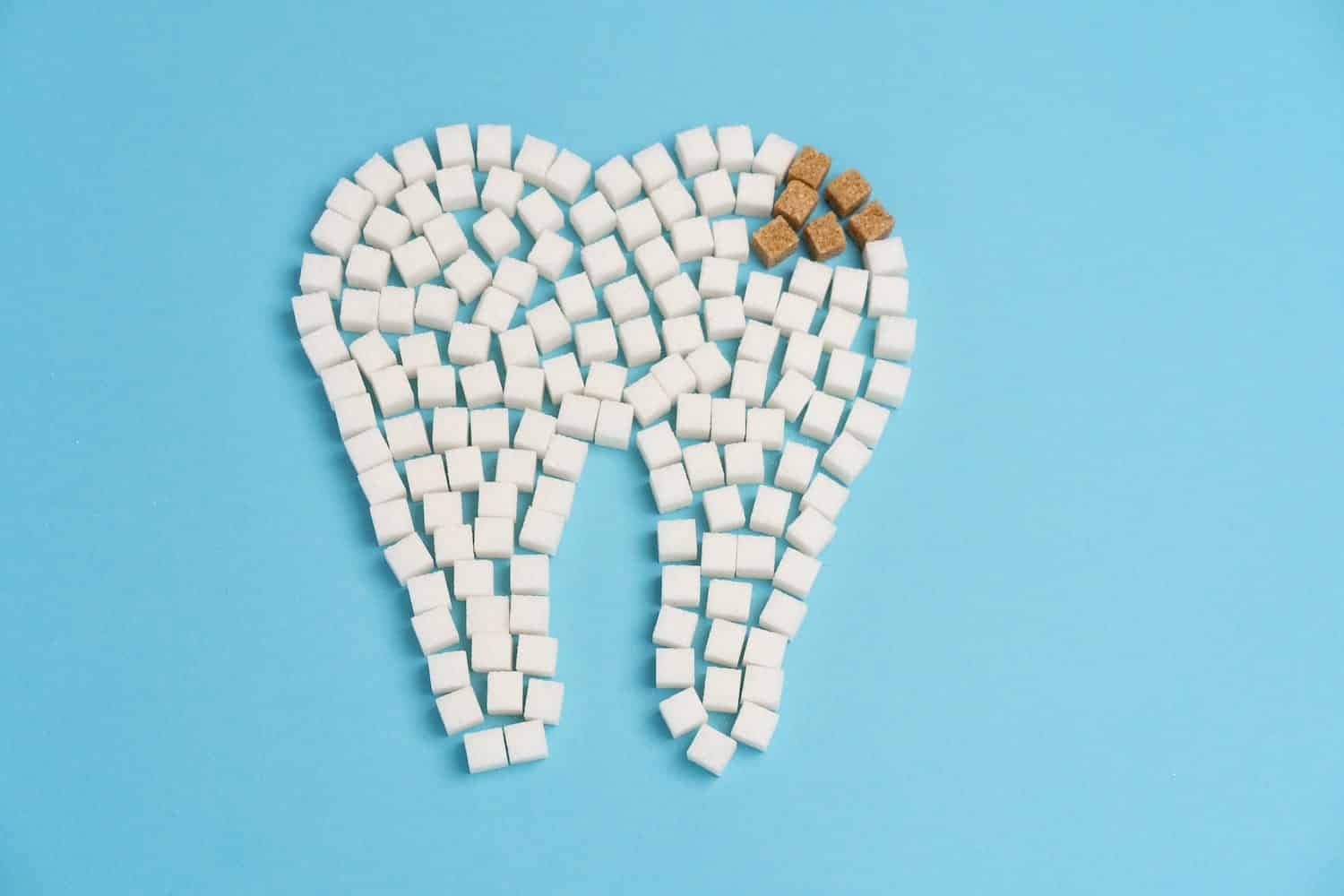 ¿Cómo se forma una caries dental?